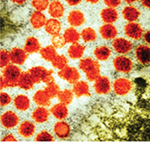 Hepatits A