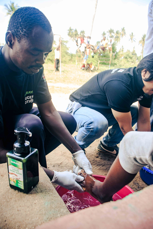 A CHP washes a patient's feet with SARAYA Antibacterial Liquid Hand Wash
