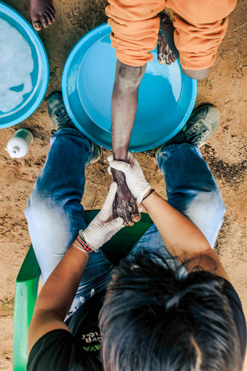 Gloves were changed between patients to prevent cross-contamination